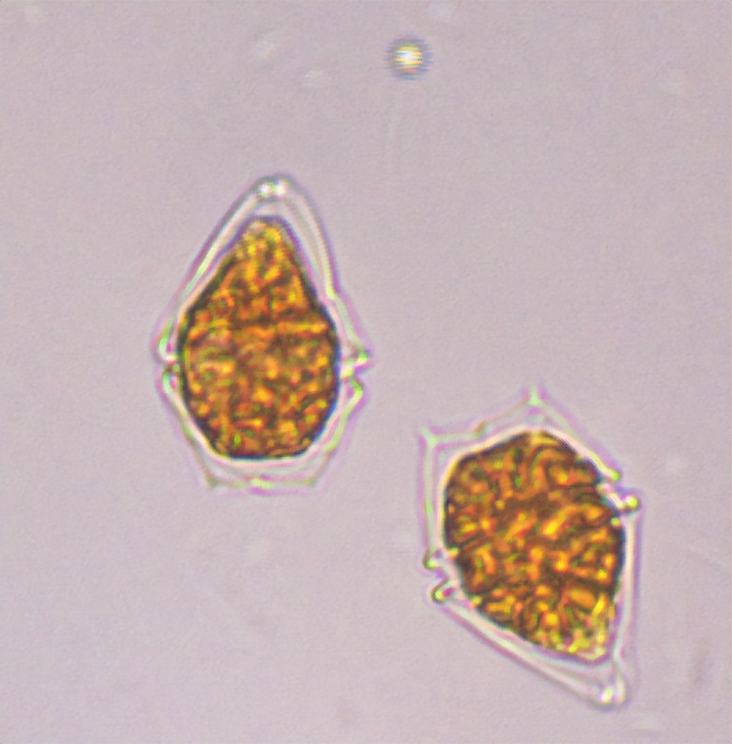 浮游植物增加会水质富营养化吗,浮游植物生长条件分析