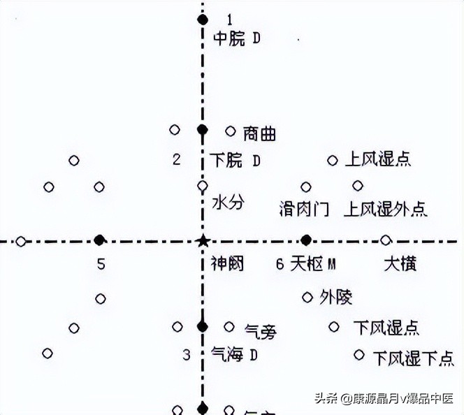 腹针疗法及16例常用处方