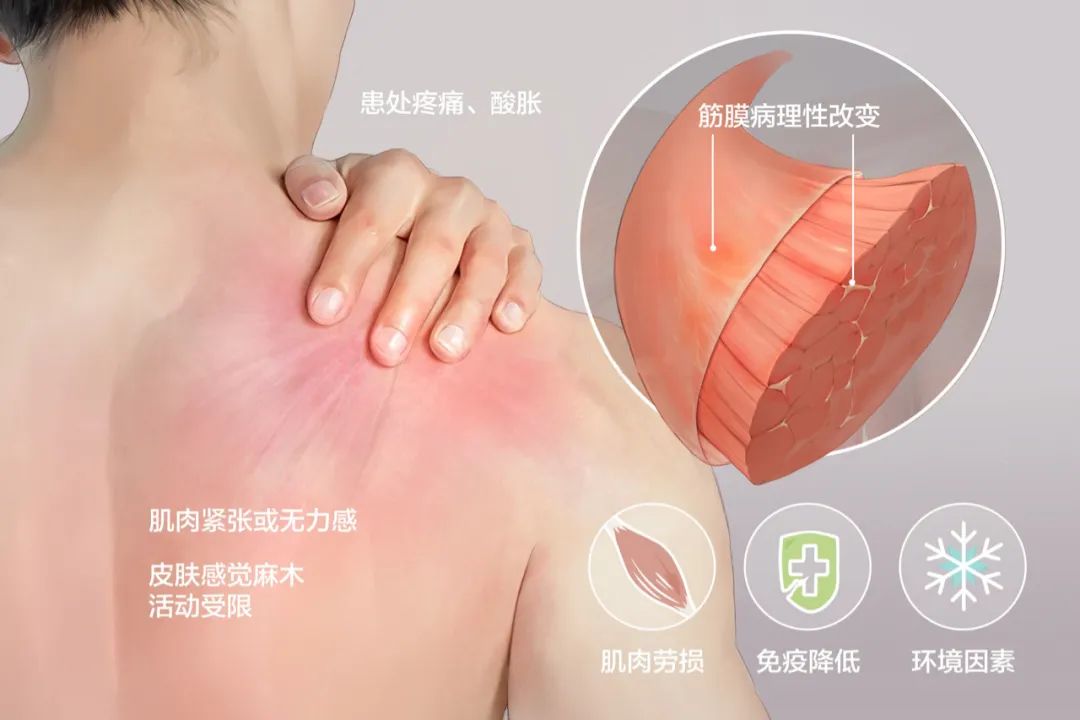 肩关节解剖及常见疾病的磁共振,肩关节常见病图解