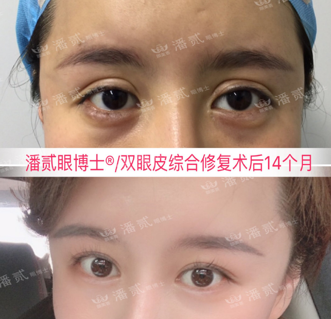 美容手术不想做了会退钱吗,美容整形不花钱