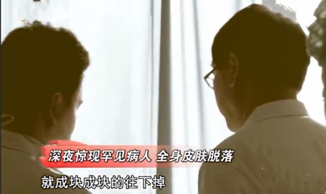 河南男子掉锅烫伤爸妈植皮救儿子,河南男子掉入油锅后续