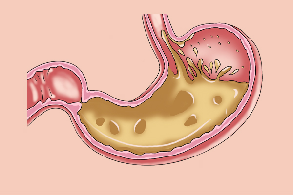 止咳黑色小药片,这种止咳药水千万别买