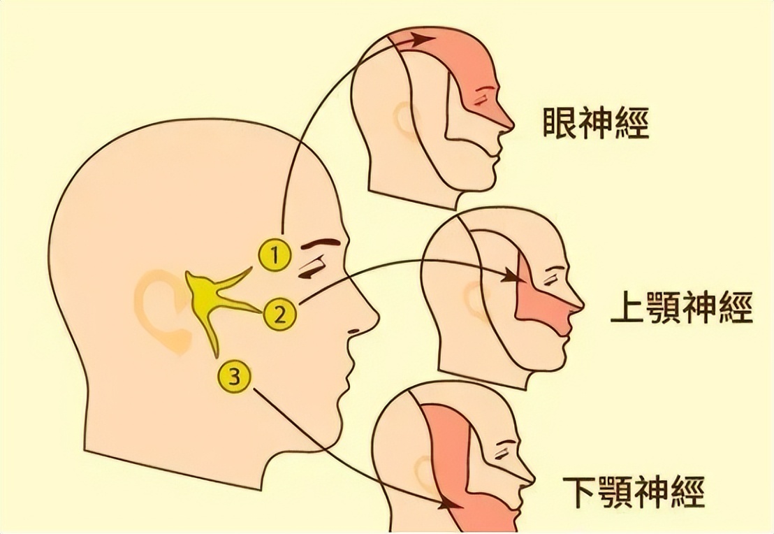 三叉神经痛伽玛刀可以维持多久,三叉神经痛伽玛刀有哪些副作用