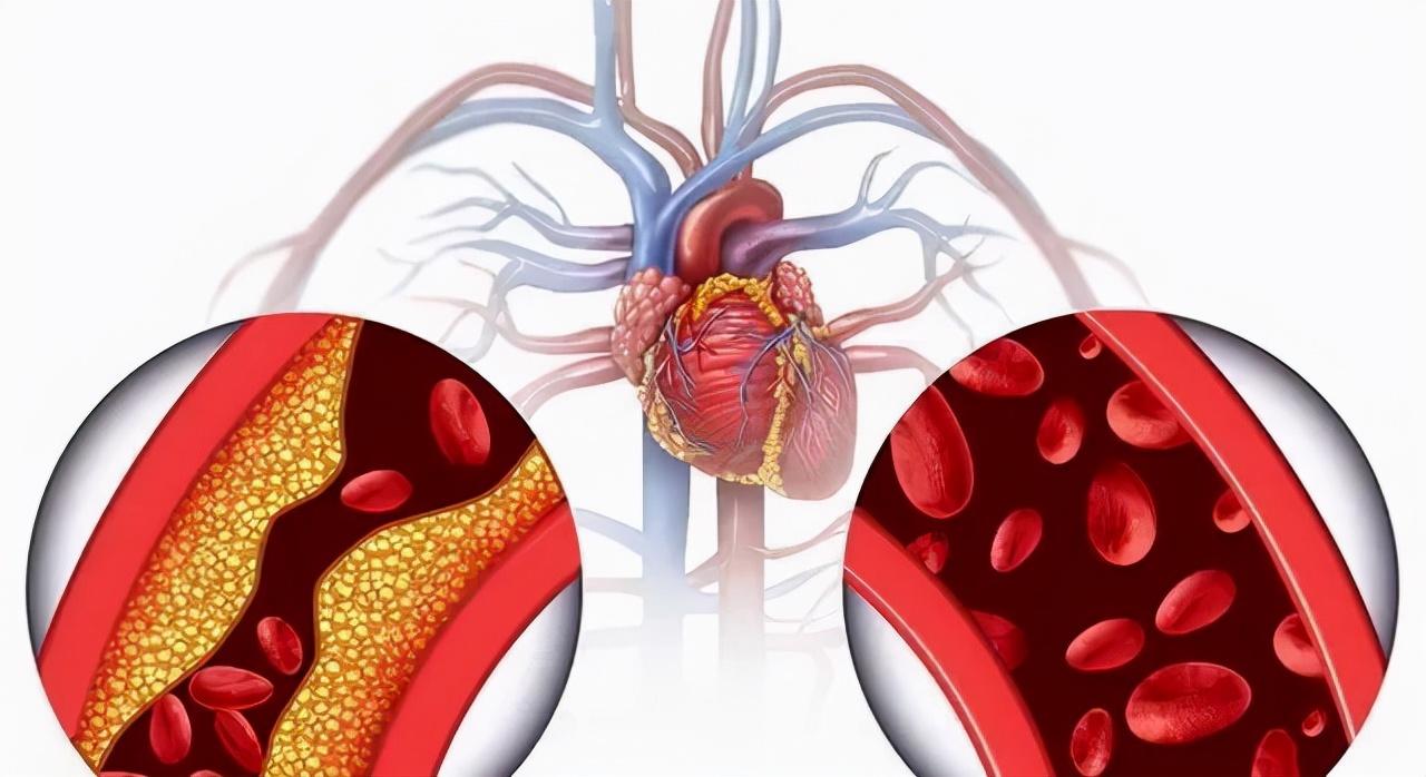 国产瑞舒伐他汀有5元多一盒的吗,进口瑞舒伐他汀10毫克28片价格表