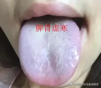 一吃凉的就胃痛食疗方法,吃了凉性食物胃痛怎么缓解
