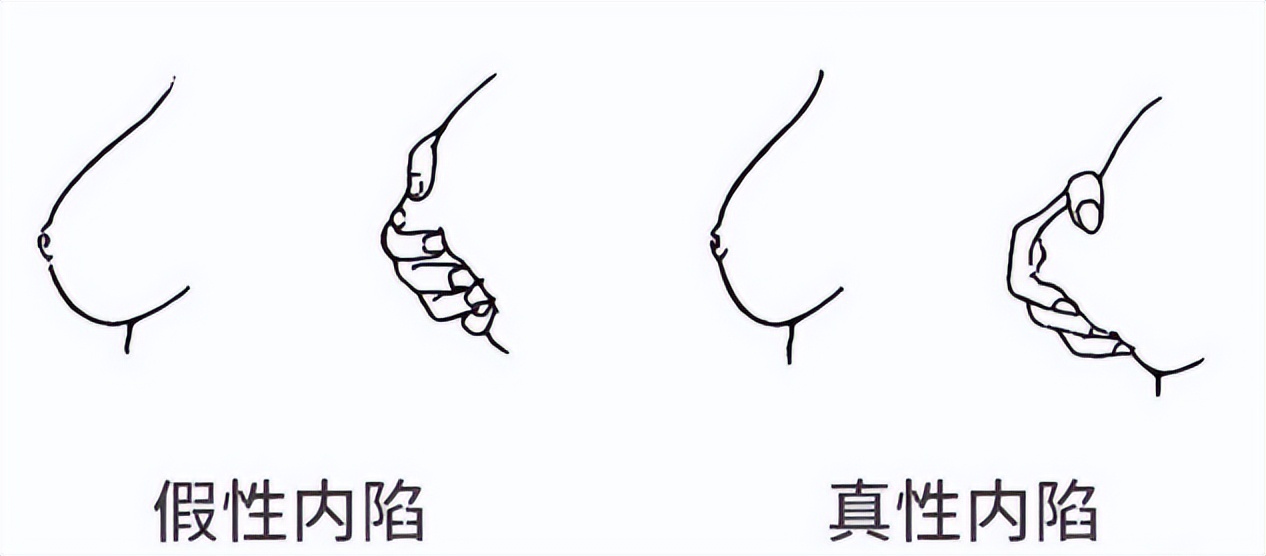 挤一挤总是有的,挤一挤总会有的下一句