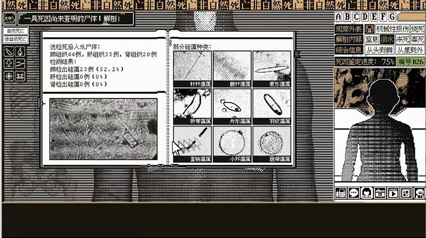 如何从尸体判断死亡原因,判断尸体死亡的六种可能