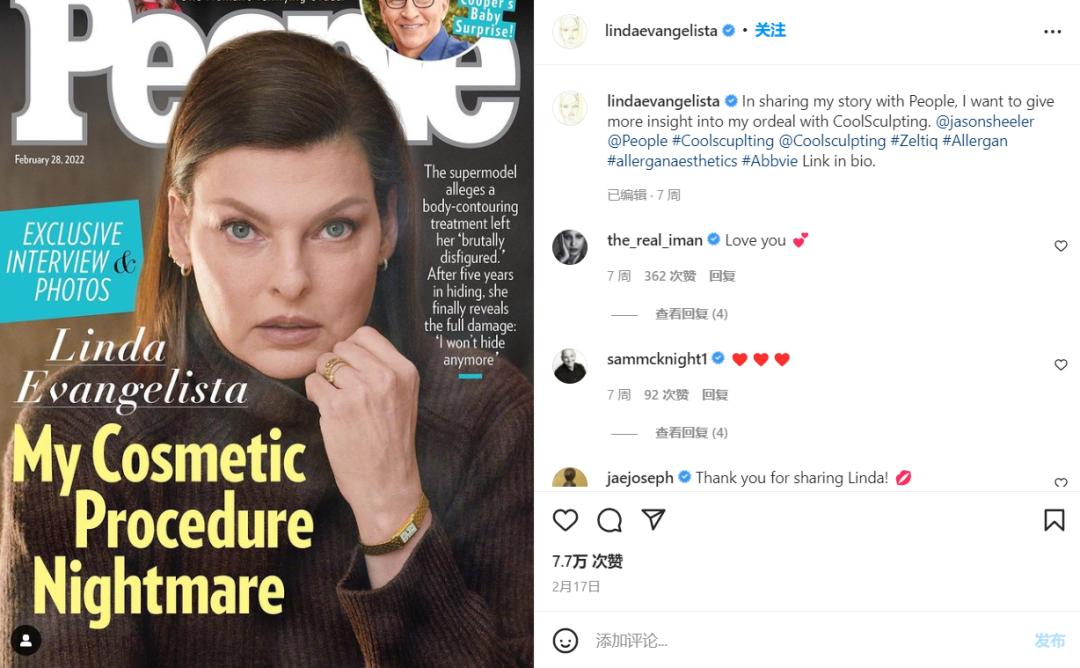 她16岁被逼拍裸照，51岁做医美永久毁容，隐退5年后勇敢发声