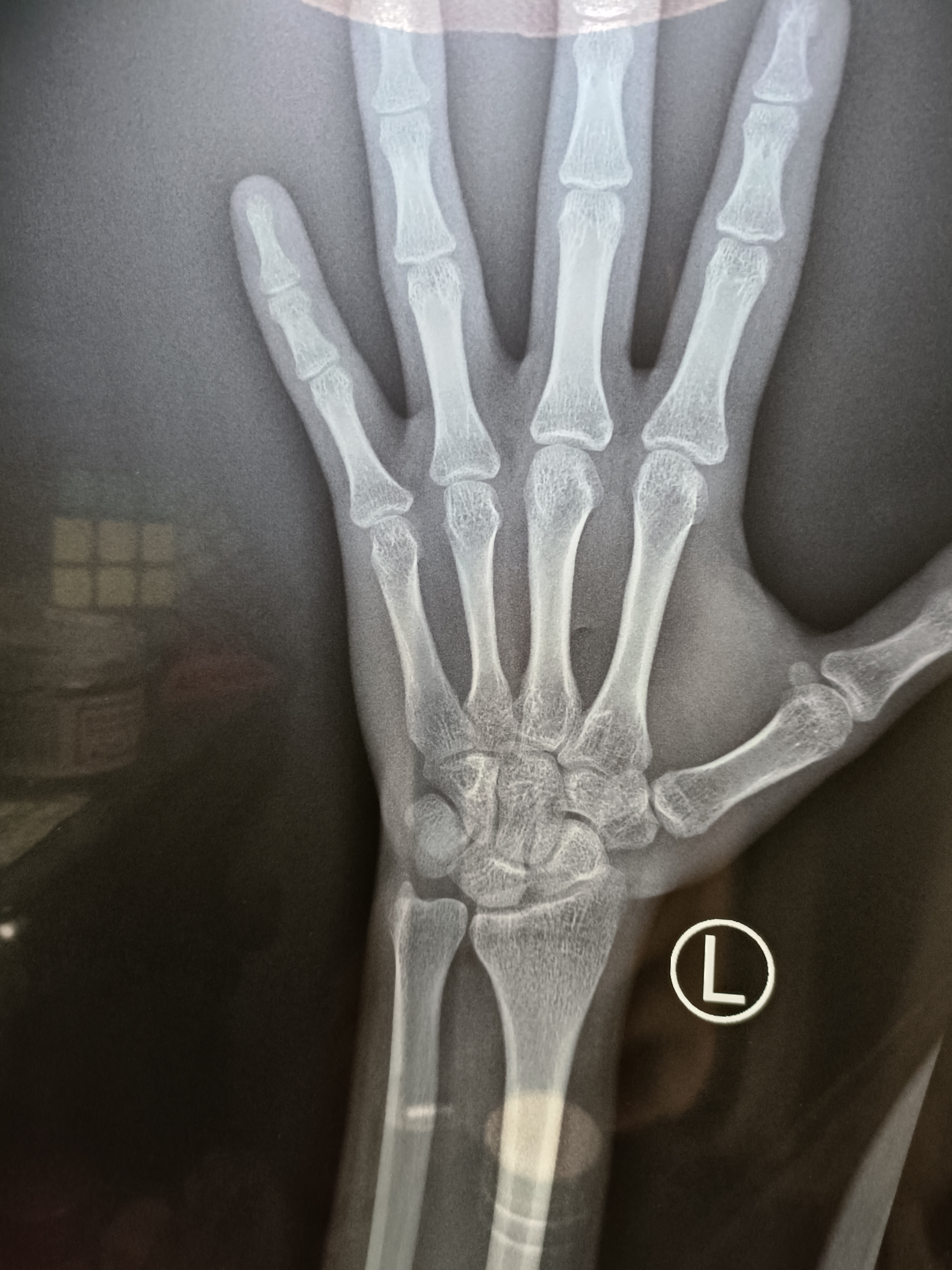 10岁男孩半年长6cm，妈妈开心不得了，医生说出真相宛如晴天霹雳