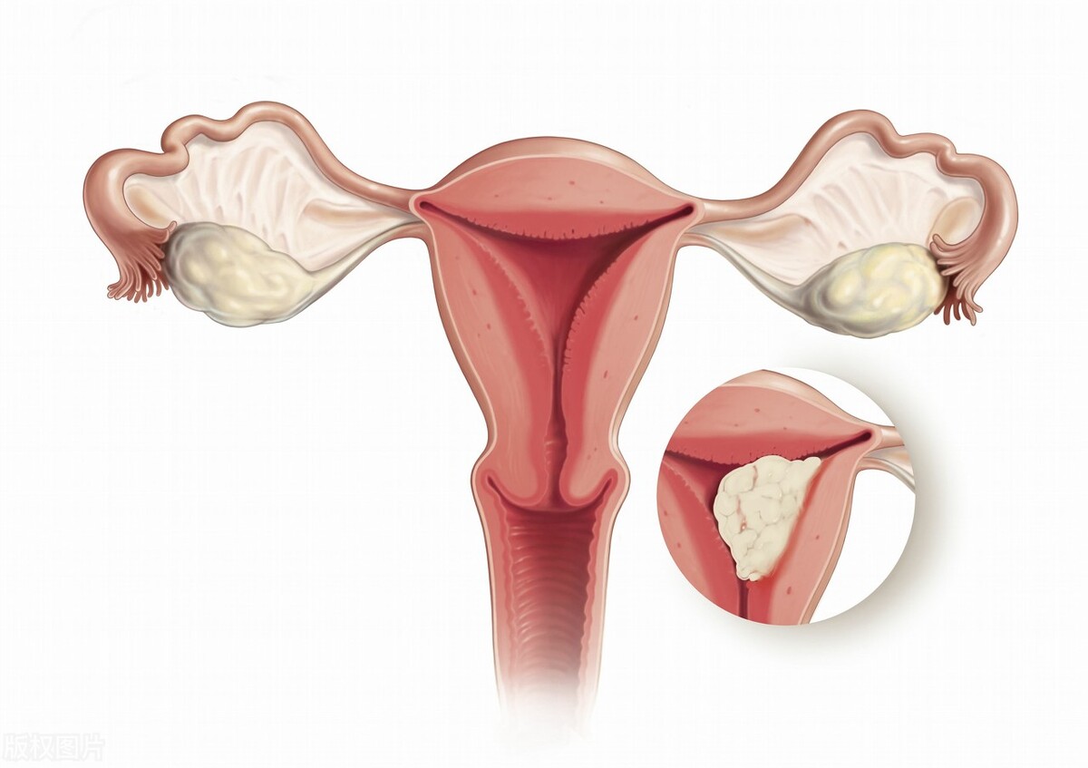 外阴肥大有什么影响吗,外阴变肥大什么原因