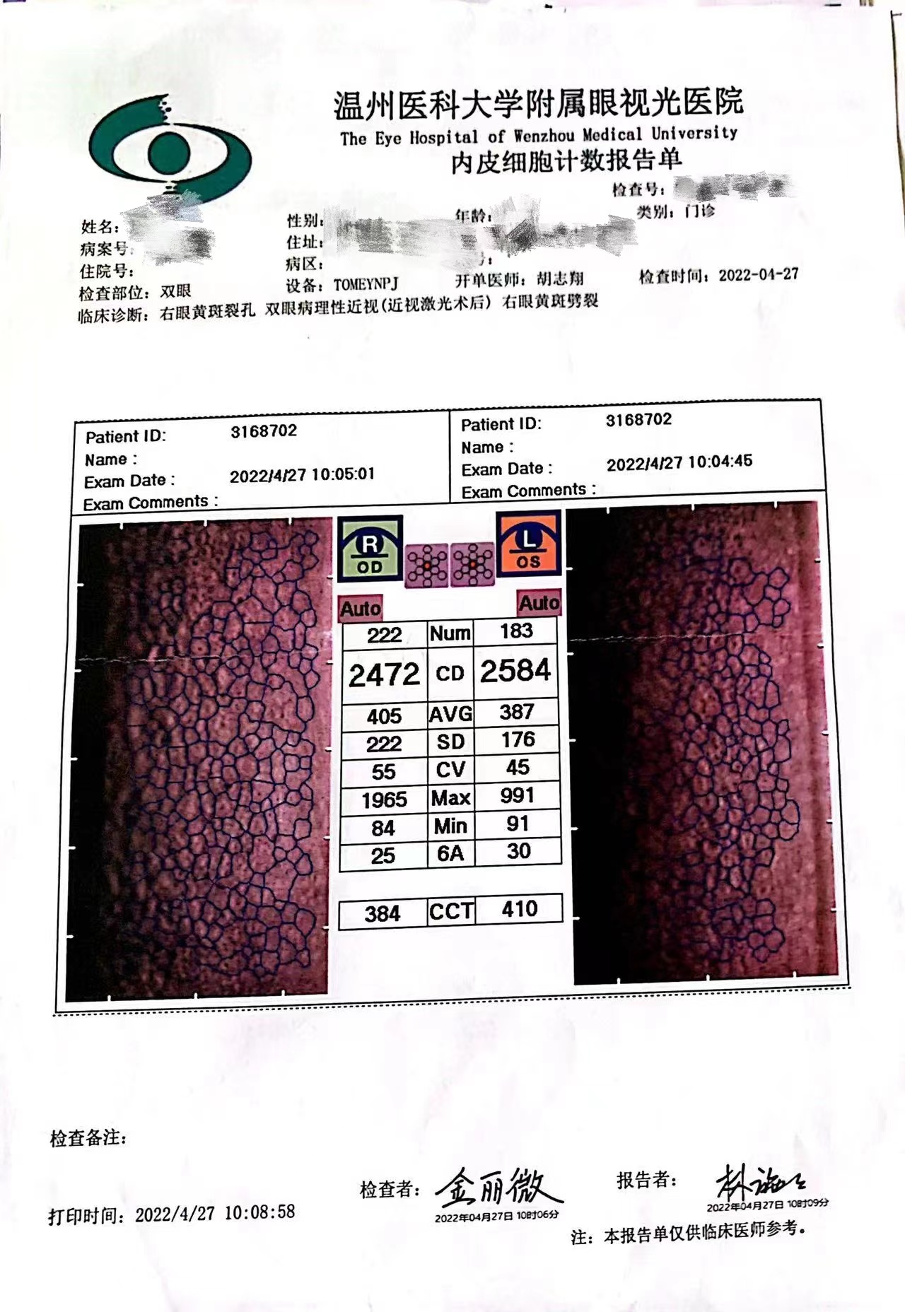 做黄斑裂孔手术是否能引起失明,女子做近视手术后又近视后续