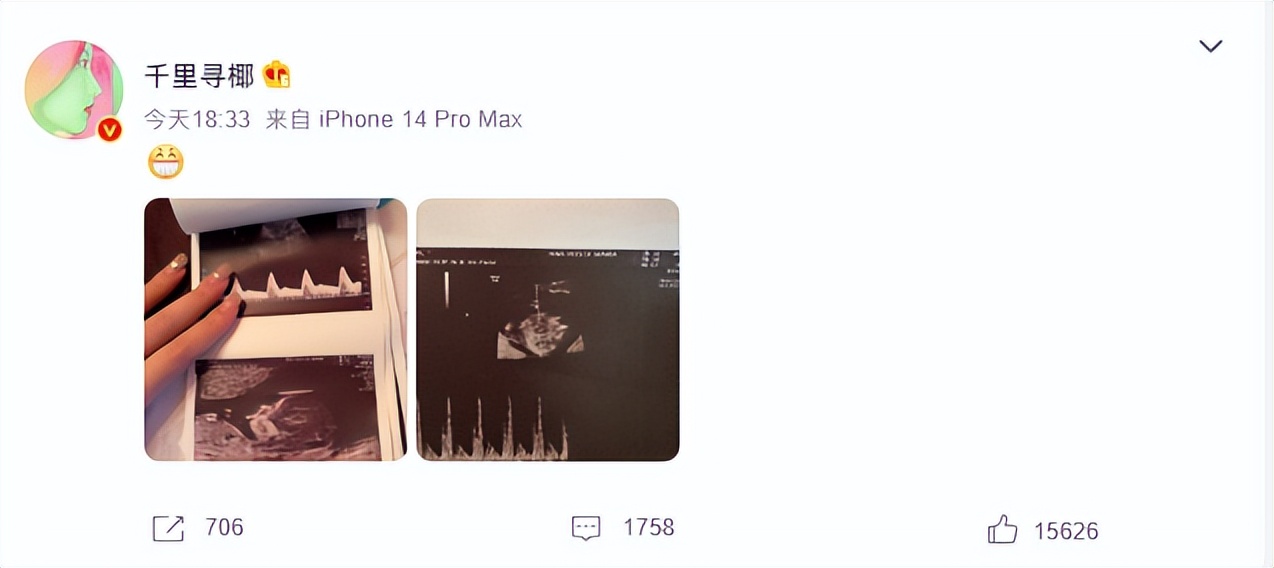 千里寻椰未婚先孕是真的吗,千里寻椰肚子里的孩子是谁的