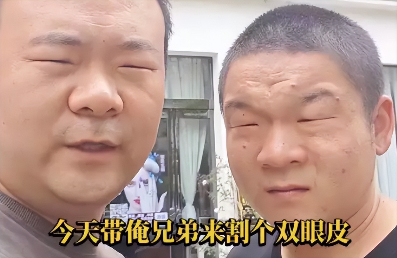 河南两男子眼太小去割双眼皮,河南两兄弟割双眼皮被劝退