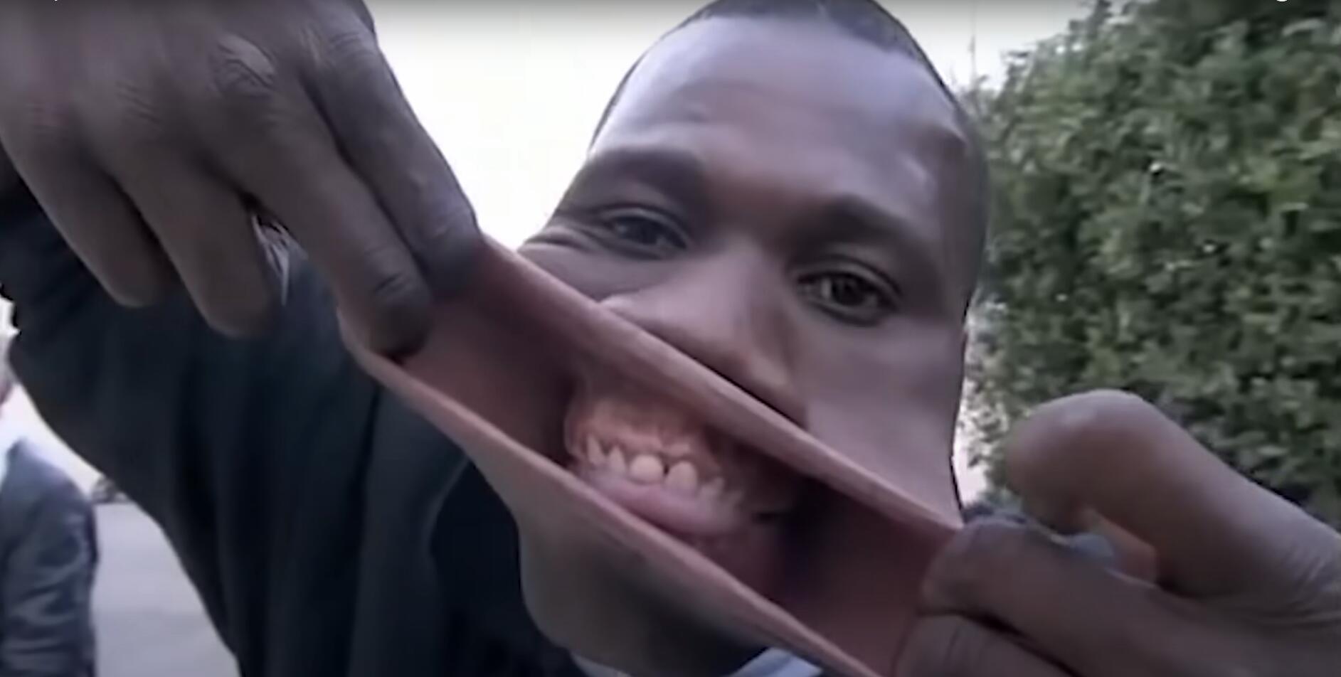 10个难以置信的人类，树皮人、外星人、拥有粗壮手臂的大力水手