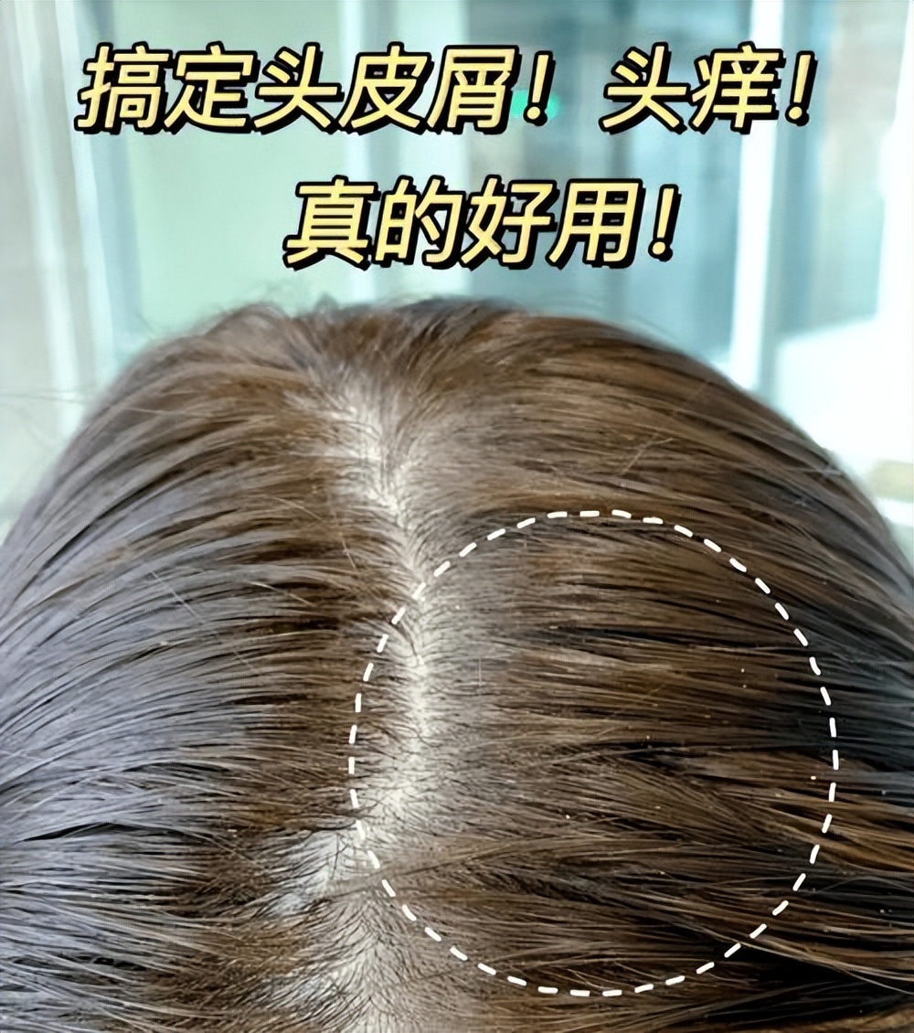 比清扬飘柔海飞丝好的洗发水,海飞丝和清扬哪个洗发水更好