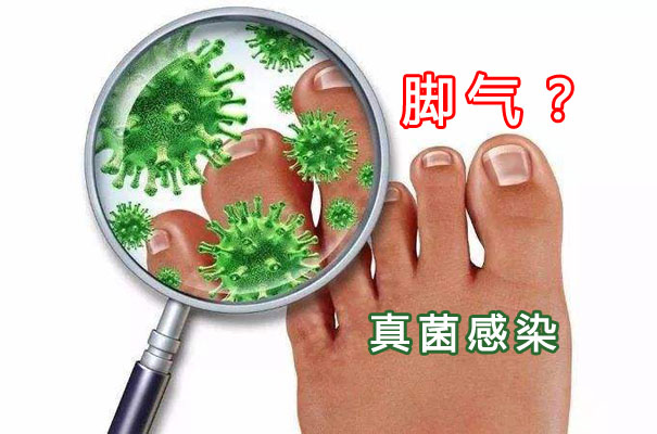 肾病患者有脚气可以用什么药,男性脚气