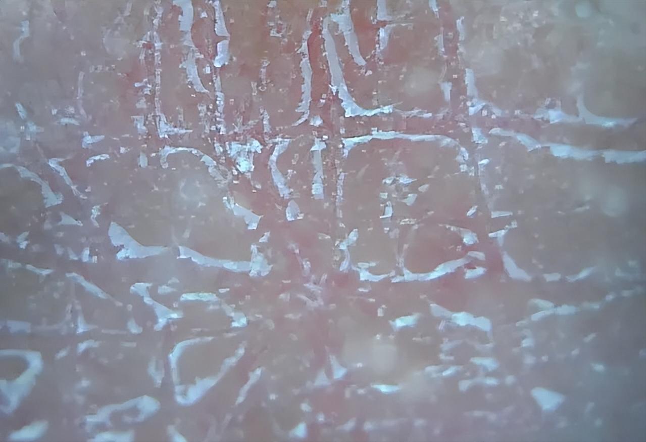 脸泛红是洗面奶的原因吗,为什么用完洗面奶脸会变白