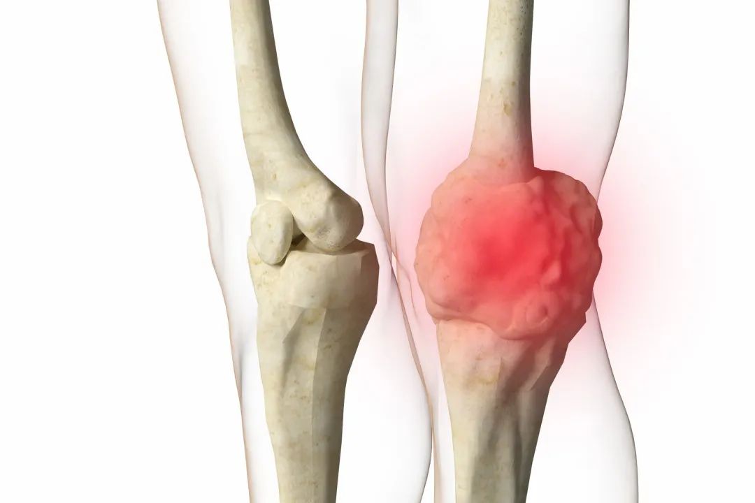 新出的抗癌药物真的有效果吗,新抗癌药可以治肺癌吗