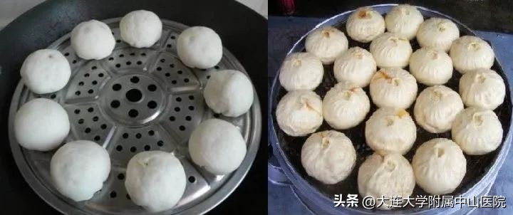 青光眼杯盘比用什么方法测量,世界青光眼日怎么防治