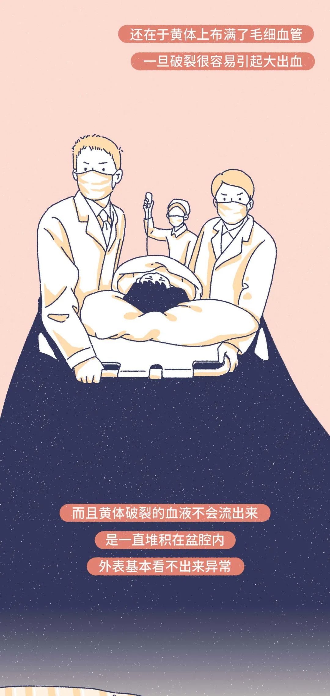 女生黄体破裂会是什么表现,什么原因会导致女性黄体破裂