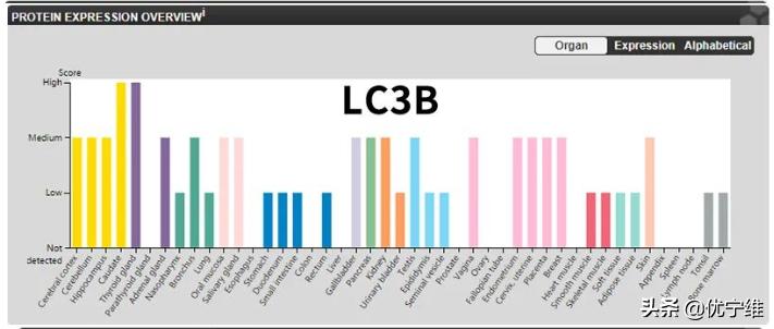 lc3自噬标记物,lc300有哪些隐藏功能