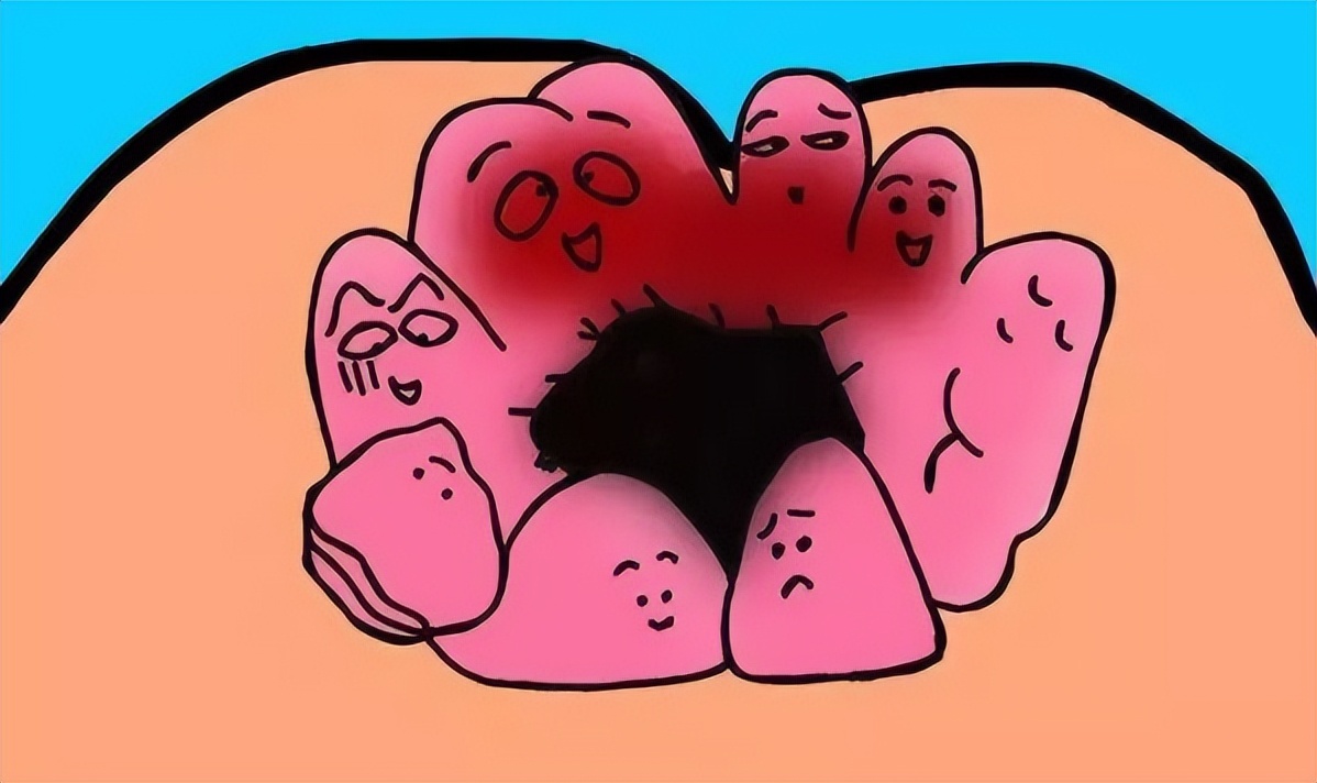 成都东大肛肠医院专治痔疮吗,东大肛肠医院做痔疮手术多少钱