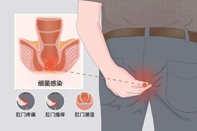 你有清洗“肛门”的习惯吗？一直这样做，或有这4个改变，别害羞