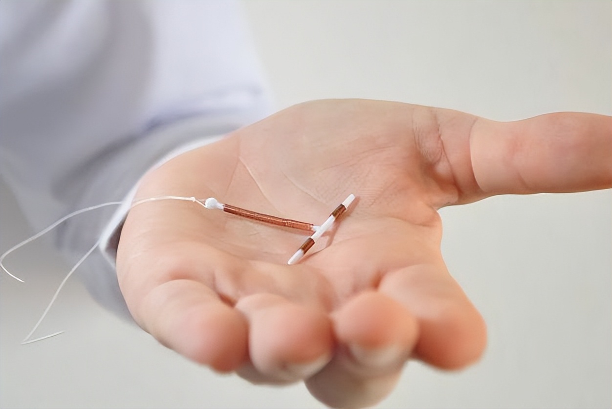 我国第一批上环的女性现在怎么样,第一批上环的女性现状