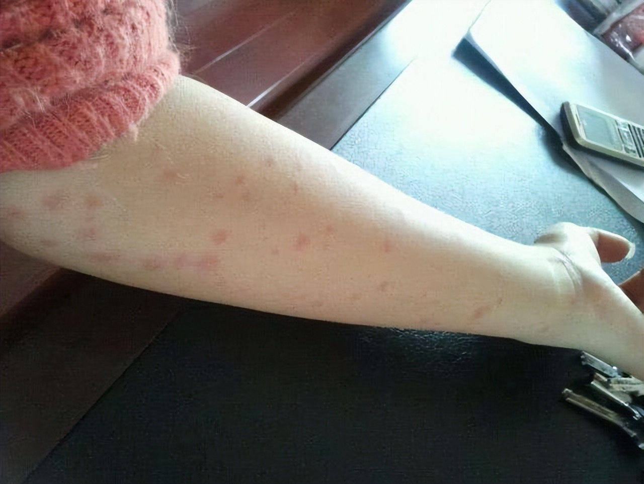 艾滋病的口腔症状有哪些？不妨查看自己是否有这3个“迹象”