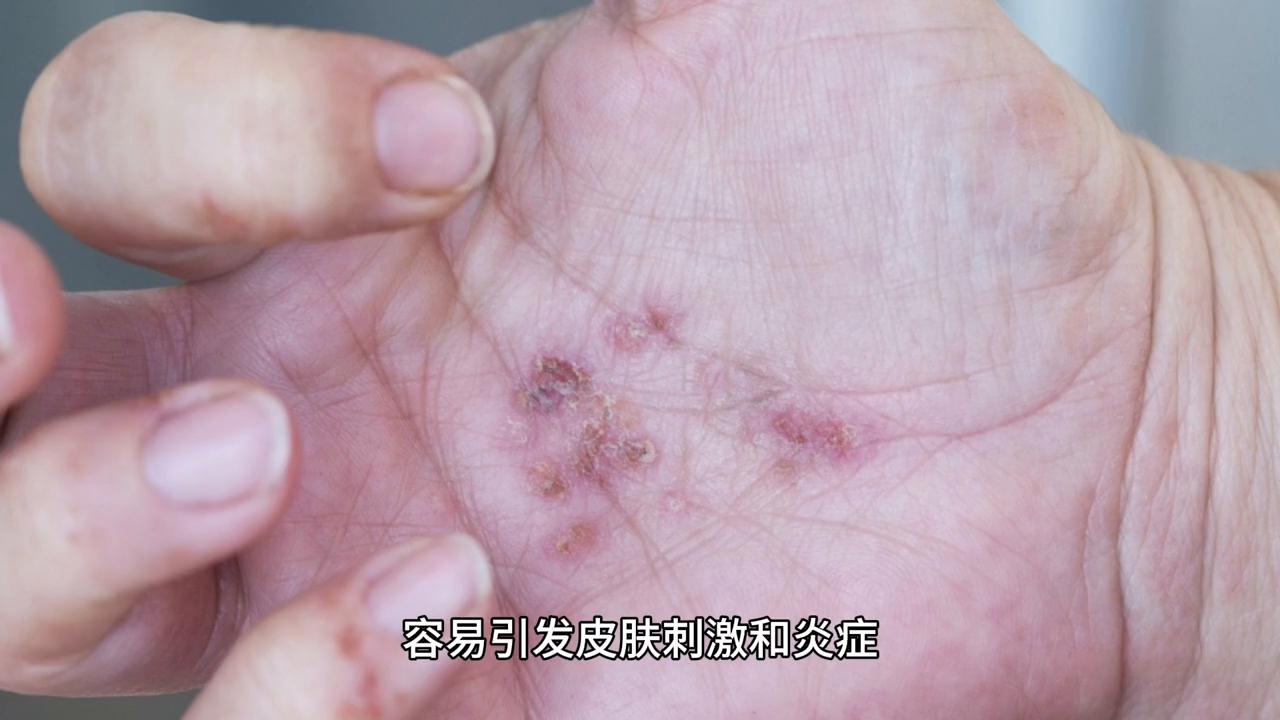 宝宝流口水特别严重怎么办,宝宝流口水严重怎么解决