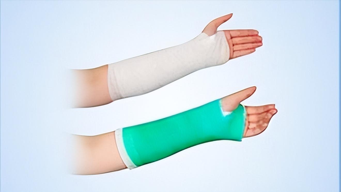 中国急性脑卒中诊治指南2014,中国脑卒中康复治疗指南pdf