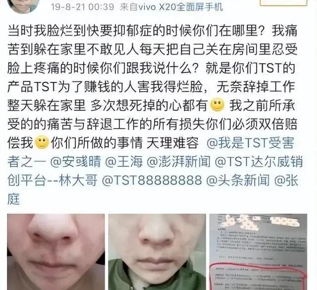 张庭涉传销事件最新进展,张庭夫妇所涉传销案细节