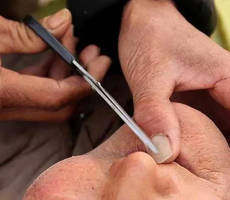 鼻毛为什么经常窜出来,鼻毛老是长出来是好还是坏