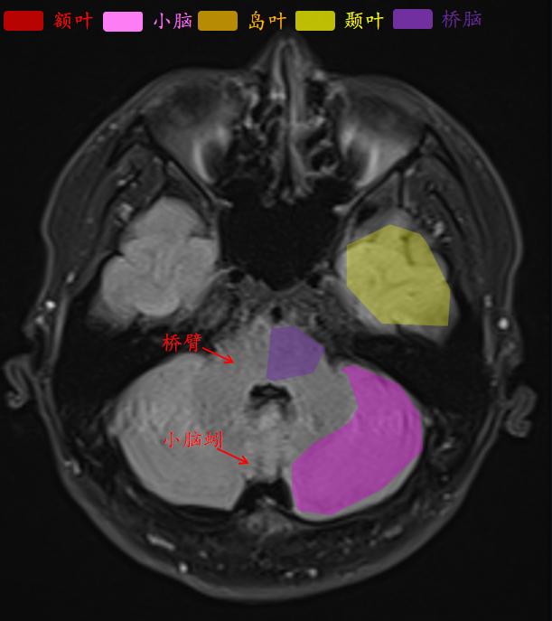 肘关节mri图谱大全,腕关节mri解剖图谱