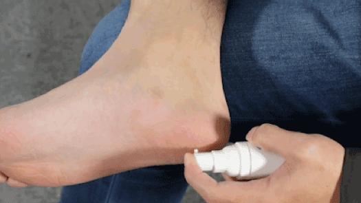 夏天脚气发作脚痒难忍用什么药膏,脚气痒脱皮有小水泡治疗小妙招