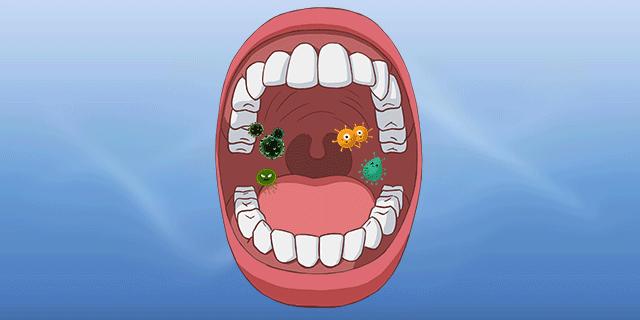 如何根治口腔口气重,一张嘴就口臭