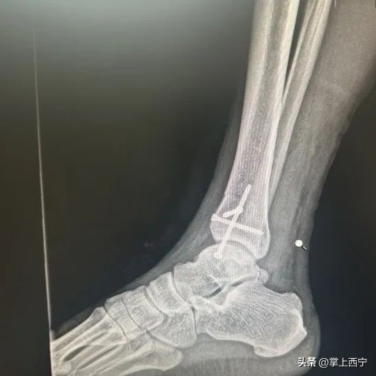 西宁市第三人民医院外科,西宁第三人民医院扩建项目