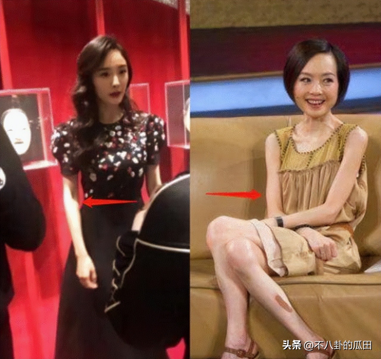 瘦到脱相的几位明星,12位瘦脱相的明星憔悴苍老