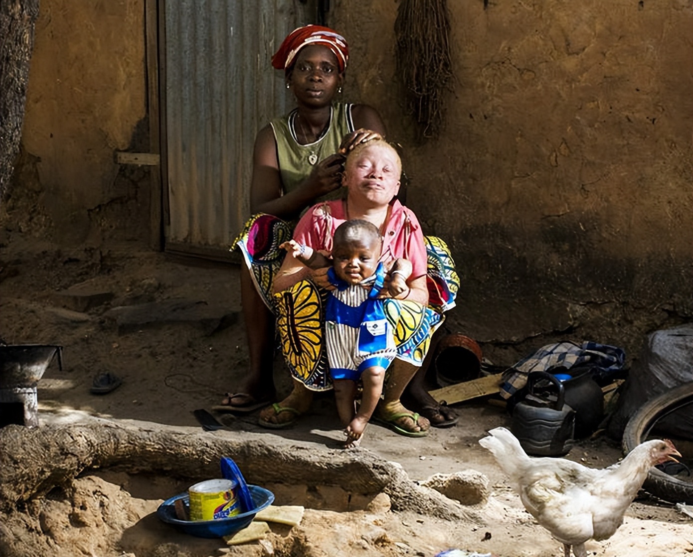 非洲最特殊的人群：血液堪比黄金，遗骸卖上百万，却无法健康成长