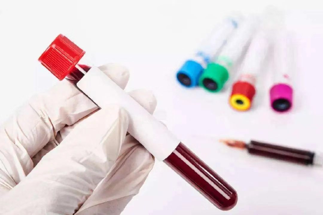 贫血就要吃红枣？补了这么多年的血，你可能补错了！