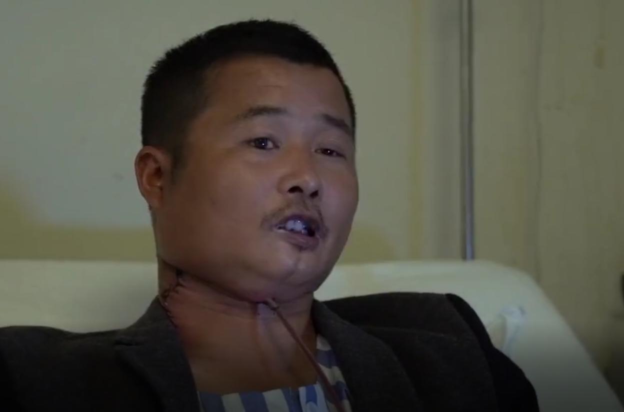 槟榔的危害的近年来数据,槟榔危害到底有多恐怖