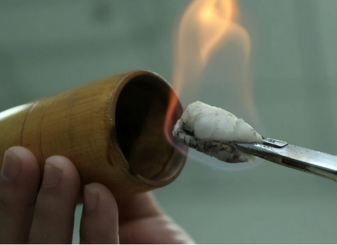 拔火罐吸出来的淤血，是体内的毒素？告诉你真相，看完涨知识