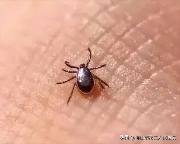 穿黄色衣服惹虫,春天穿黄色衣服招虫吗