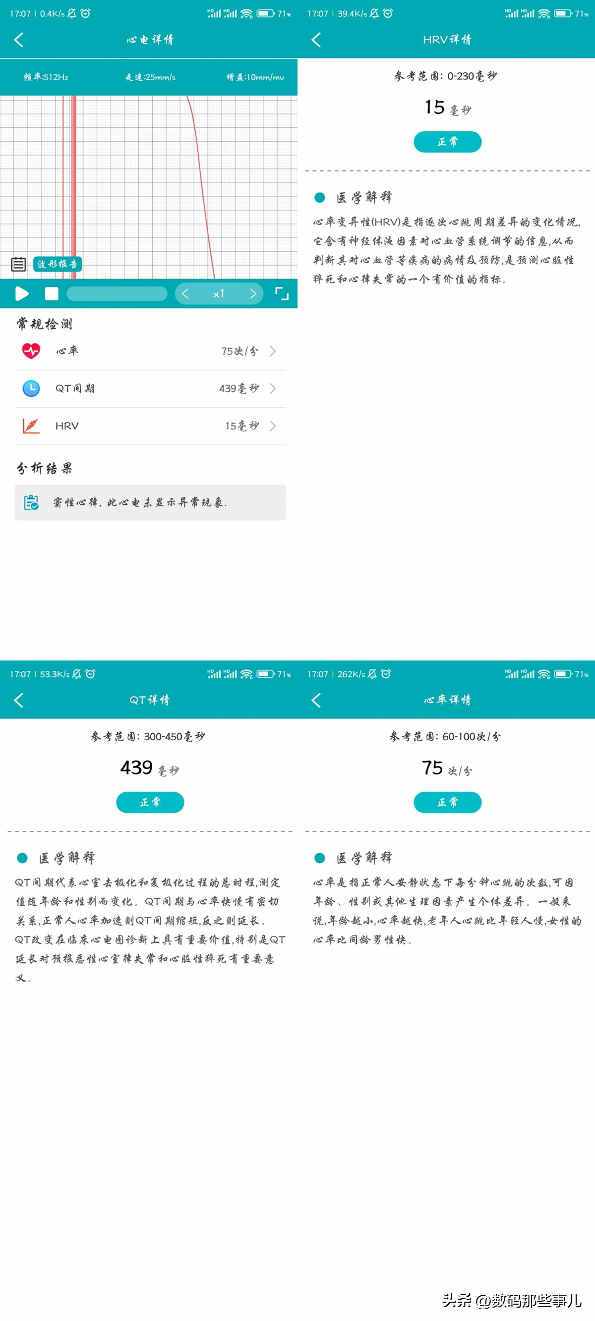 dido智能手环f50s血糖准吗,f50spro智能手环能测血糖吗