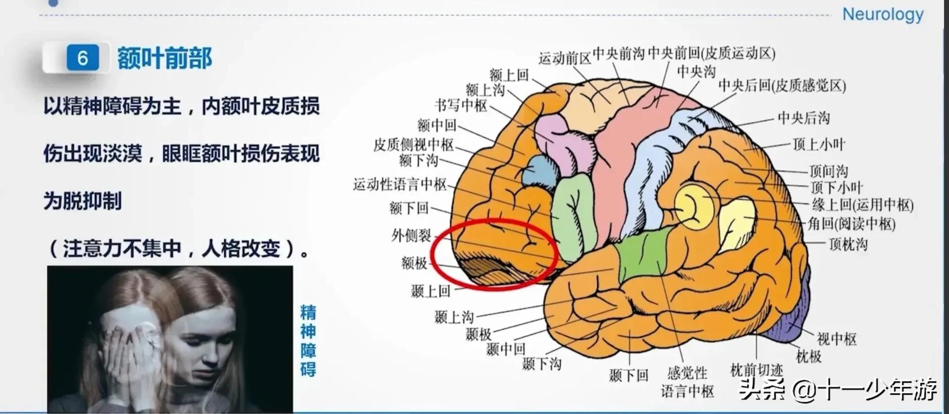 大脑的结构解剖示意图,大脑镰下疝解剖结构