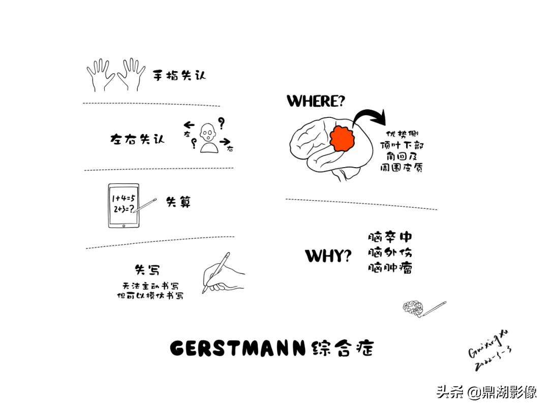 大脑皮层的解剖与定位,大脑解剖学习绘图笔记