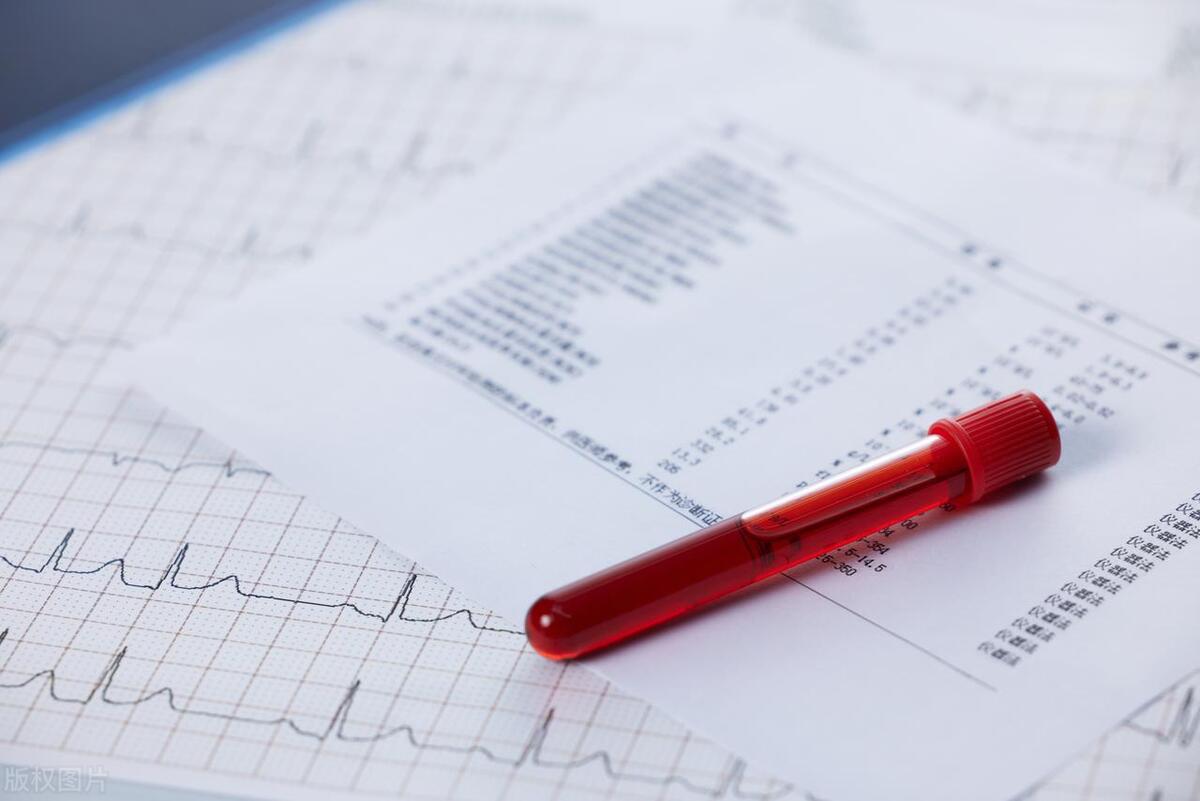 游泳会引起急性膀胱炎吗,女子游泳得膀胱炎