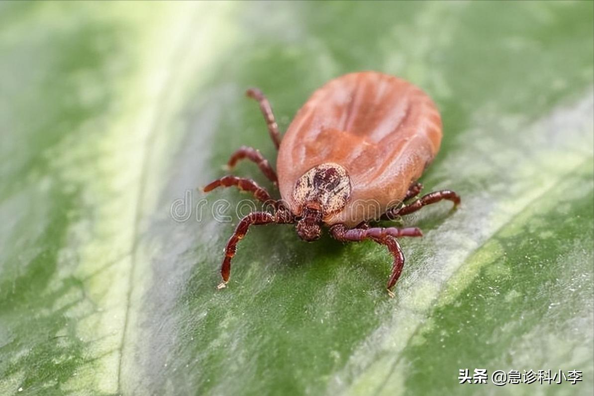 夺命蜱虫咬了是什么样子,夺命蜱虫一家三口被咬两人丧命