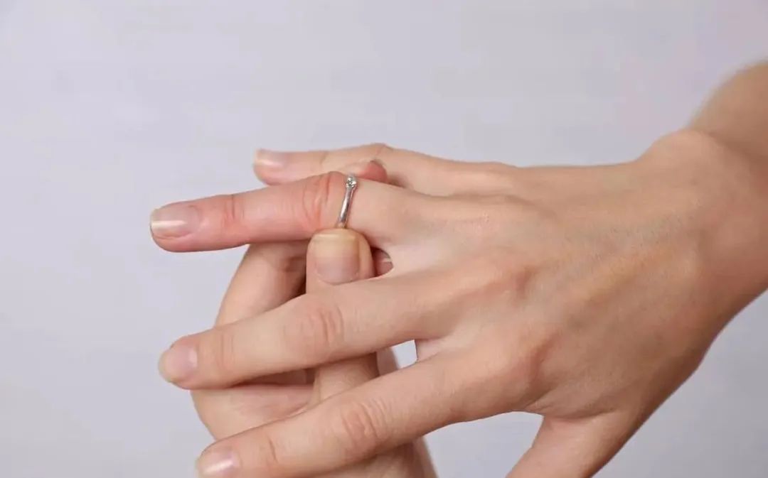 戒指太紧取不下来怎么办教你一招,铁丝戒指卡住了取不下来了怎么办