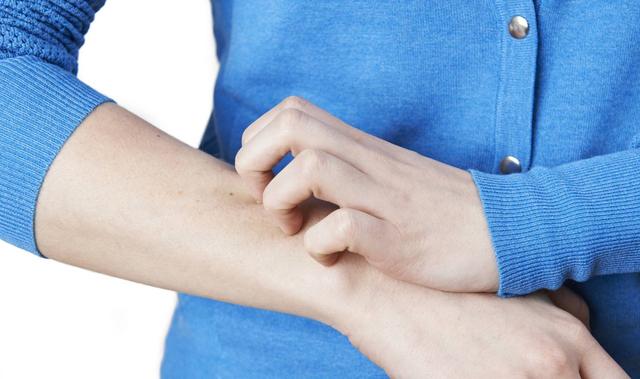 冬天来了皮肤干燥脱衣服有皮屑,冬天皮肤很干燥全是皮屑